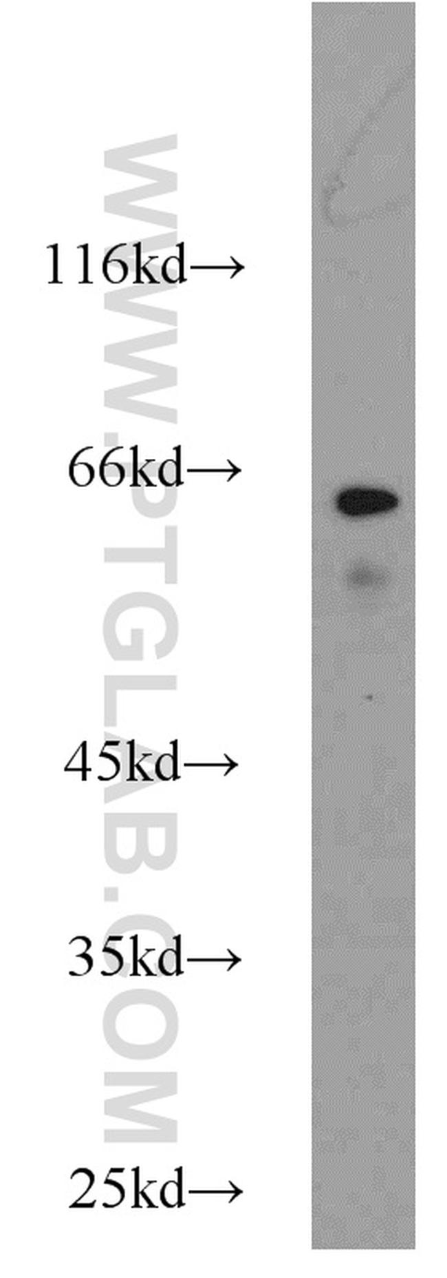 TAK1 Antibody in Western Blot (WB)