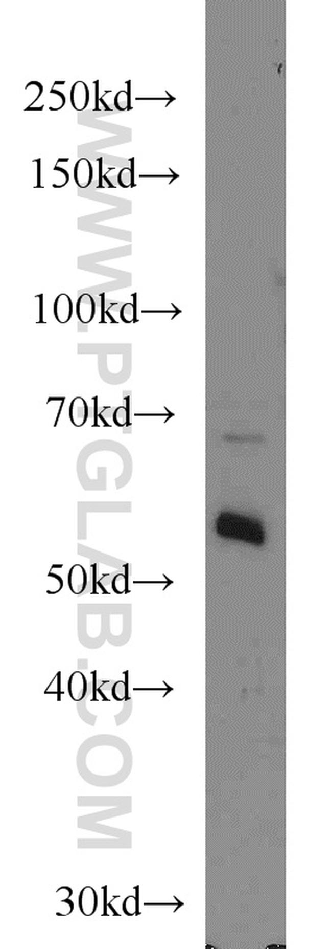 TAK1 Antibody in Western Blot (WB)