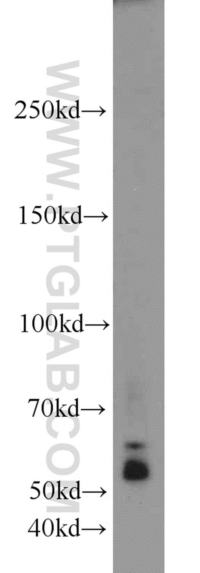 TAK1 Antibody in Western Blot (WB)