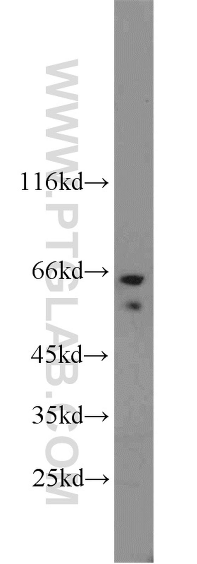 TAK1 Antibody in Western Blot (WB)