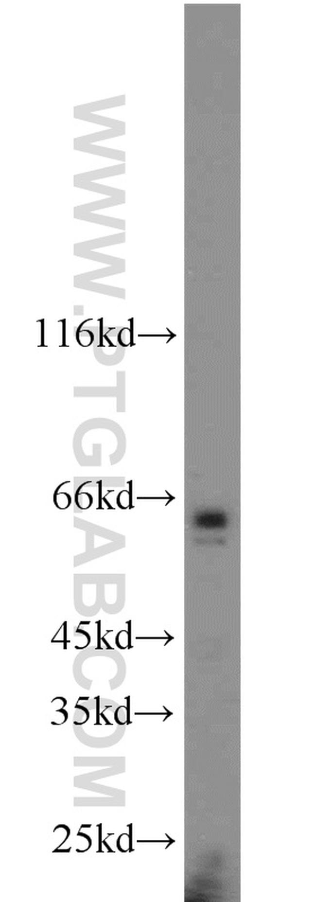 TAK1 Antibody in Western Blot (WB)