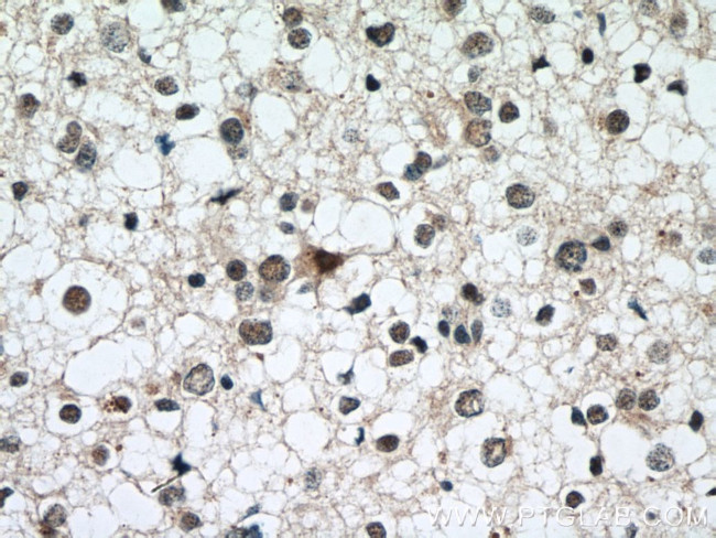 ASH2L Antibody in Immunohistochemistry (Paraffin) (IHC (P))