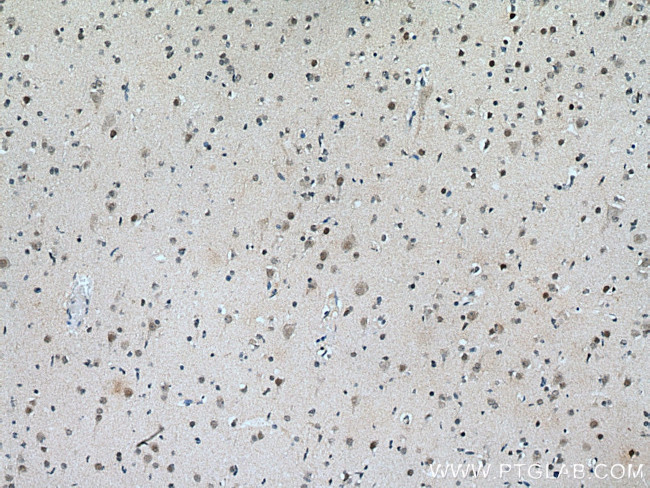 ASH2L Antibody in Immunohistochemistry (Paraffin) (IHC (P))