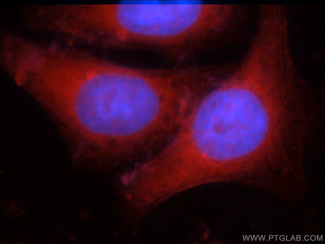 IDH1 Antibody in Immunocytochemistry (ICC/IF)