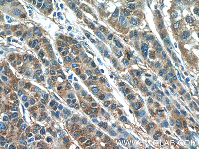 IDH1 Antibody in Immunohistochemistry (Paraffin) (IHC (P))