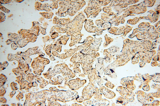 IDH1 Antibody in Immunohistochemistry (Paraffin) (IHC (P))