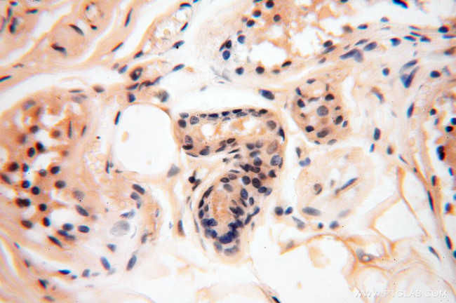 IDH1 Antibody in Immunohistochemistry (Paraffin) (IHC (P))