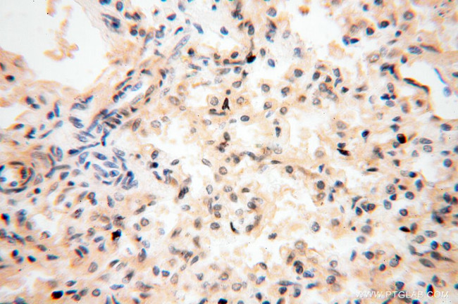 IDH1 Antibody in Immunohistochemistry (Paraffin) (IHC (P))