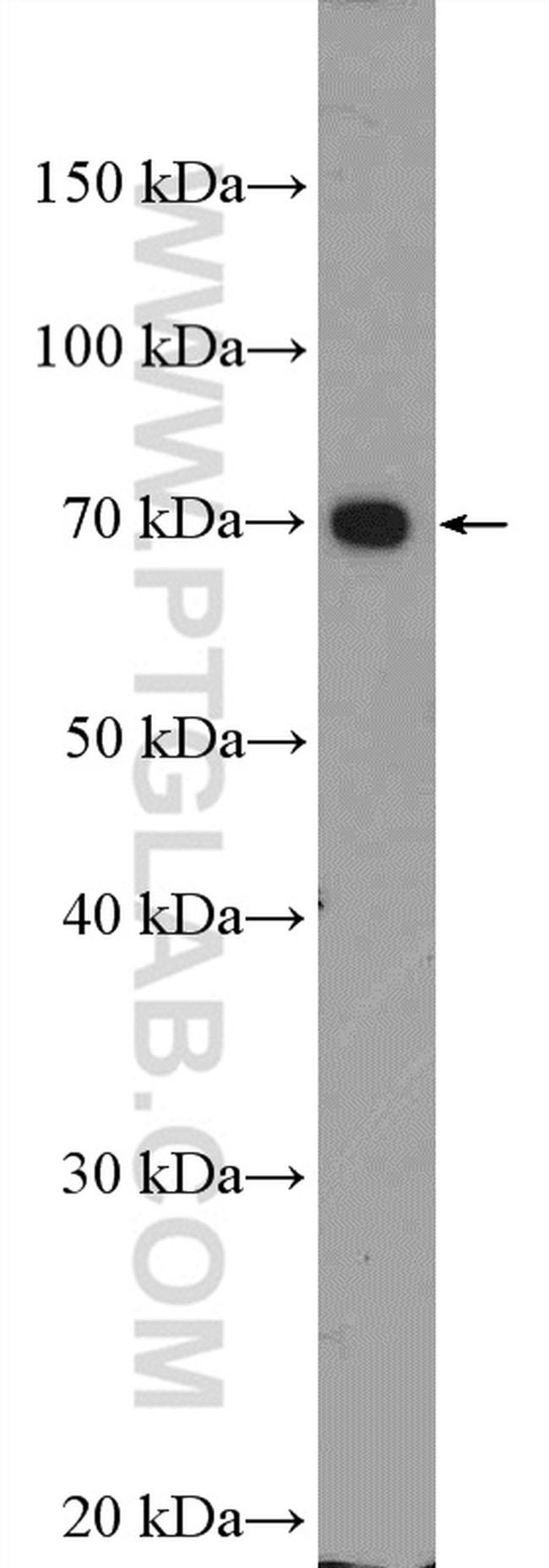 UBE3C Antibody in Western Blot (WB)