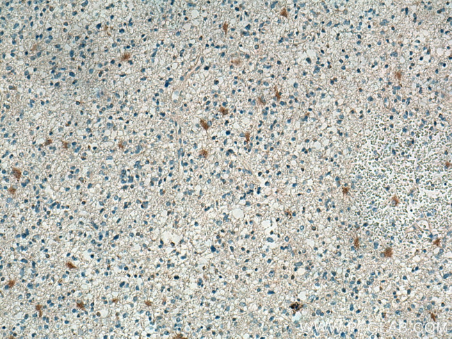 GRO alpha Antibody in Immunohistochemistry (Paraffin) (IHC (P))