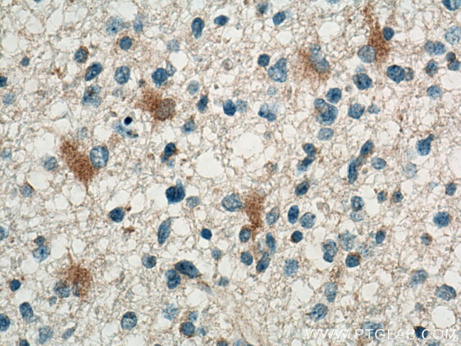 GRO alpha Antibody in Immunohistochemistry (Paraffin) (IHC (P))