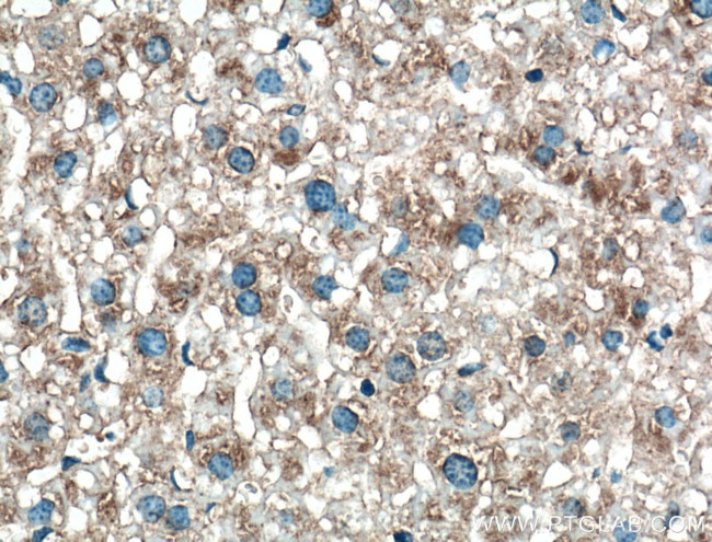 GRO alpha Antibody in Immunohistochemistry (Paraffin) (IHC (P))