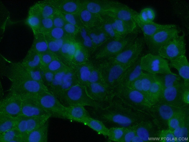 SDPR Antibody in Immunocytochemistry (ICC/IF)