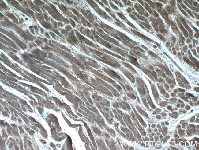 SDPR Antibody in Immunohistochemistry (Paraffin) (IHC (P))