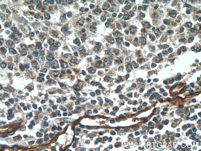 SDPR Antibody in Immunohistochemistry (Paraffin) (IHC (P))