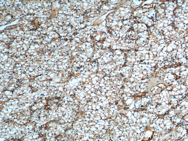 SDPR Antibody in Immunohistochemistry (Paraffin) (IHC (P))