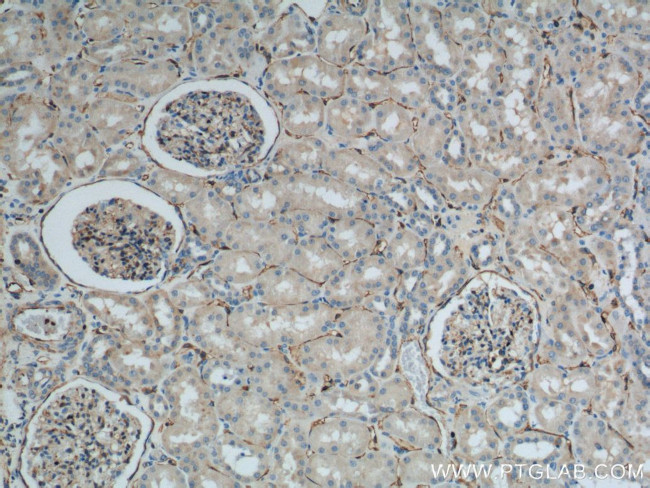 SDPR Antibody in Immunohistochemistry (Paraffin) (IHC (P))