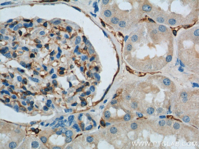 SDPR Antibody in Immunohistochemistry (Paraffin) (IHC (P))