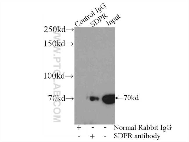 SDPR Antibody in Immunoprecipitation (IP)