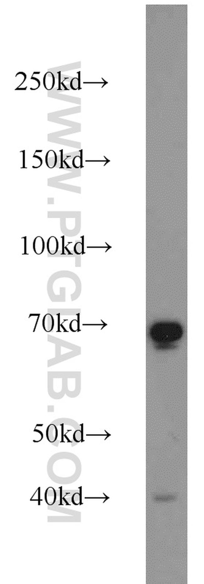 SDPR Antibody in Western Blot (WB)