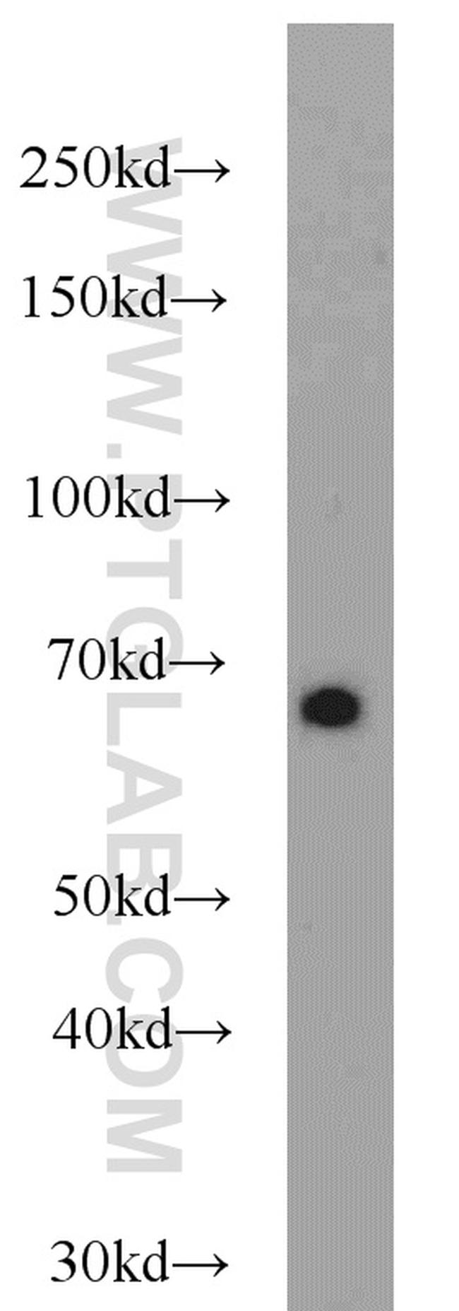 SDPR Antibody in Western Blot (WB)