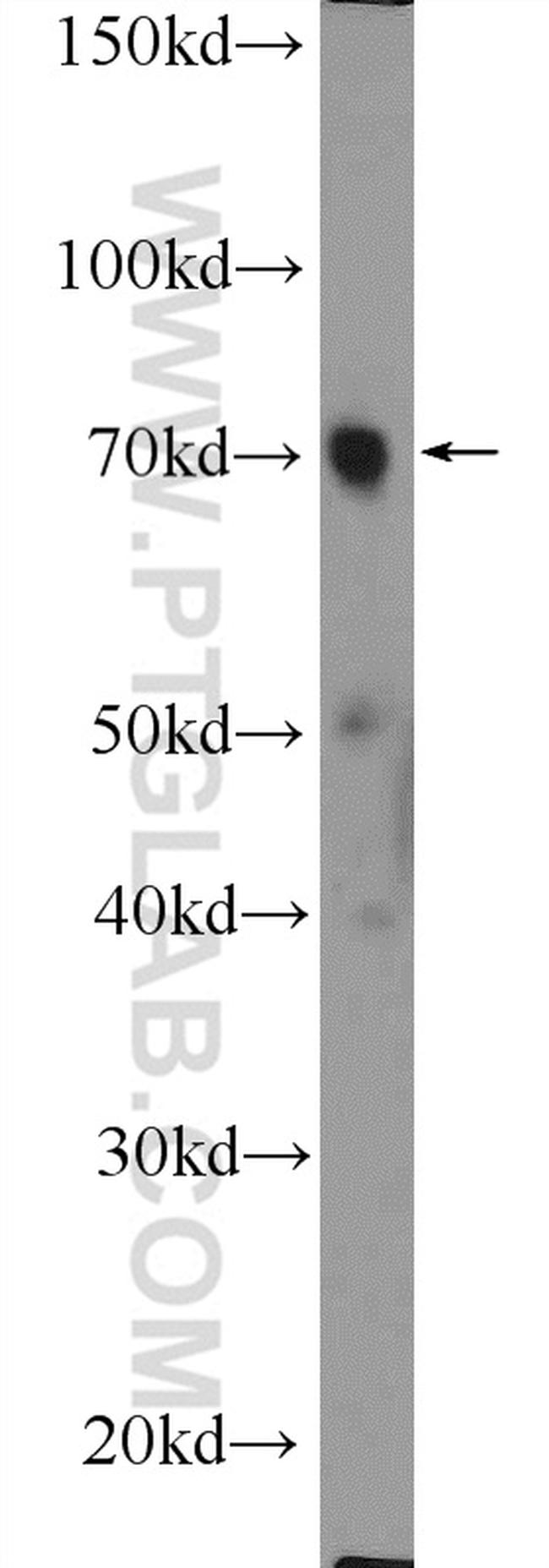 SDPR Antibody in Western Blot (WB)