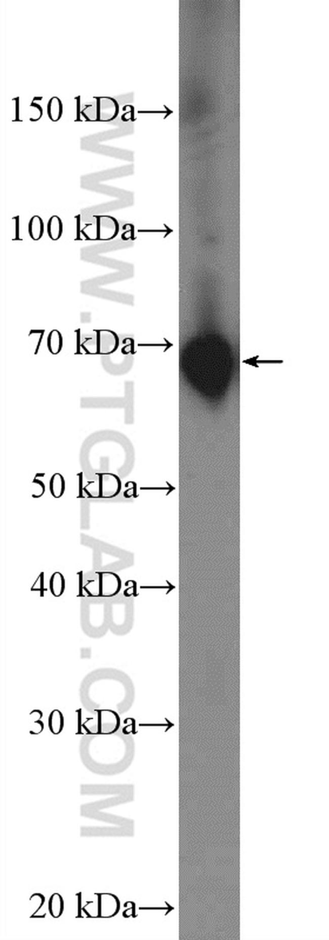 SDPR Antibody in Western Blot (WB)