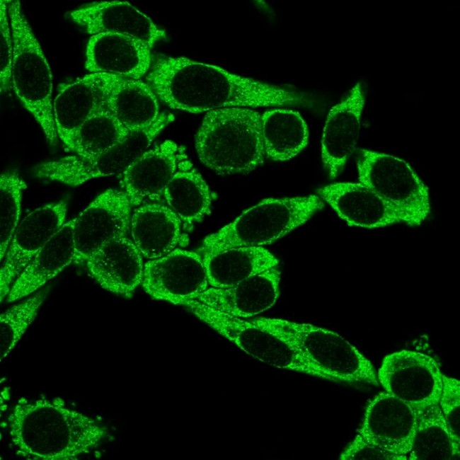 CD195 (CC-Chemokine Receptor 5) Antibody in Immunocytochemistry (ICC/IF)