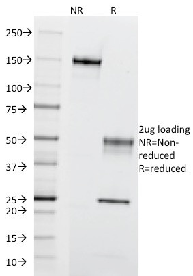 CD195 (CC-Chemokine Receptor 5) Antibody in SDS-PAGE (SDS-PAGE)