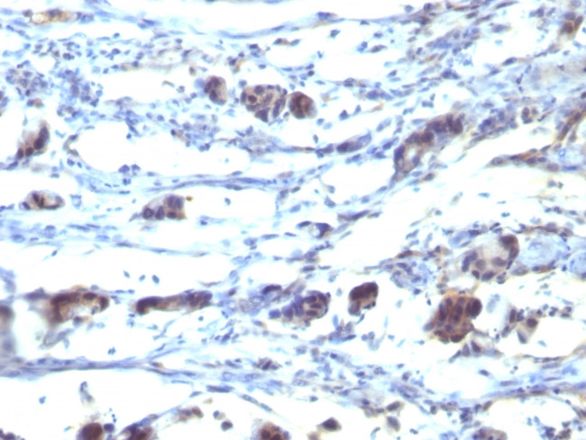 CD195 (CC-Chemokine Receptor 5) Antibody in Immunohistochemistry (Paraffin) (IHC (P))