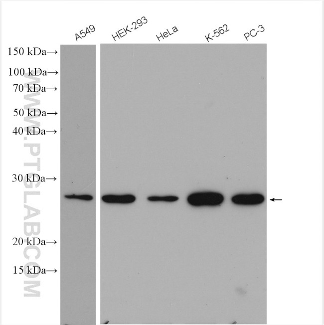 PSMD10 Antibody in Western Blot (WB)