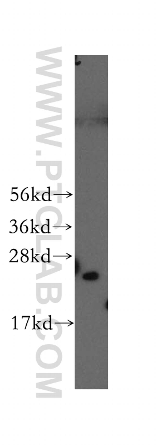 PSMD10 Antibody in Western Blot (WB)