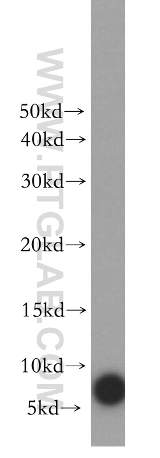 S100A3 Antibody in Western Blot (WB)