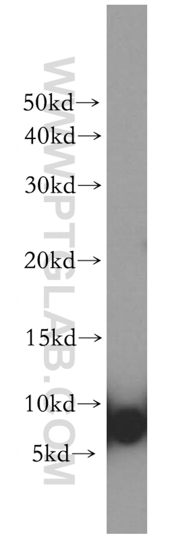 S100A3 Antibody in Western Blot (WB)