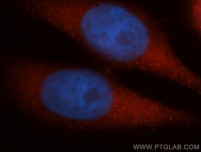 DYNC1H1 Antibody in Immunocytochemistry (ICC/IF)