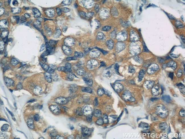 DYNC1H1 Antibody in Immunohistochemistry (Paraffin) (IHC (P))