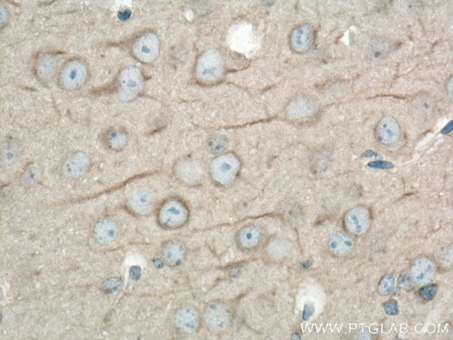 DYNC1H1 Antibody in Immunohistochemistry (Paraffin) (IHC (P))