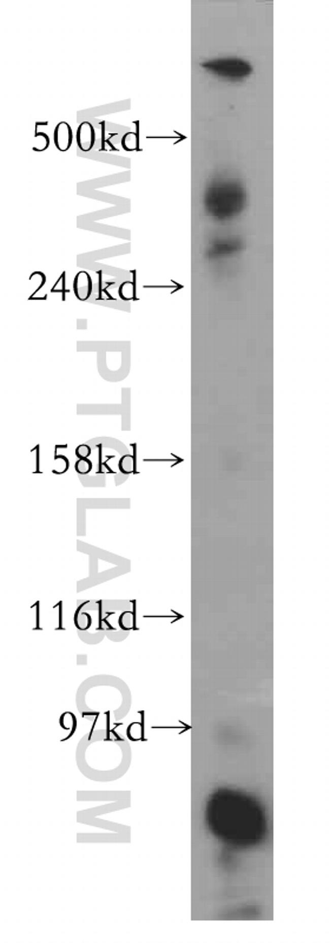 DYNC1H1 Antibody in Western Blot (WB)