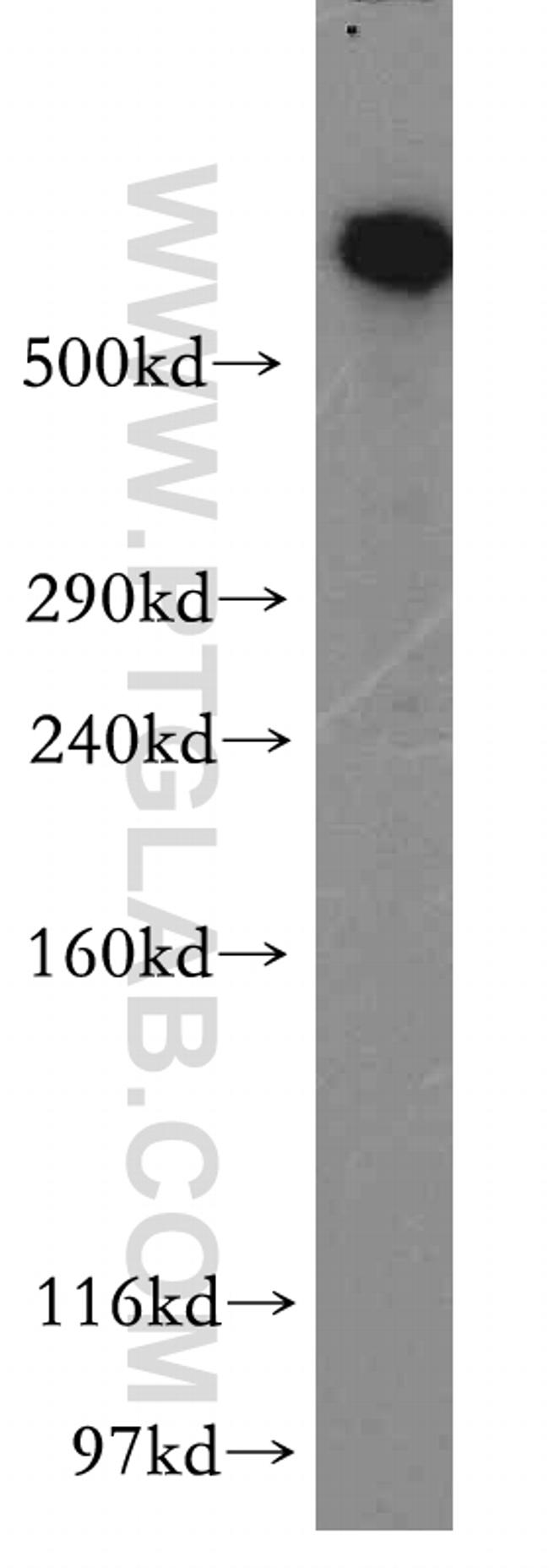 DYNC1H1 Antibody in Western Blot (WB)