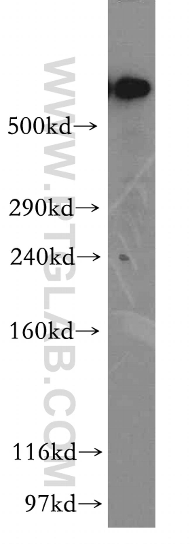 DYNC1H1 Antibody in Western Blot (WB)