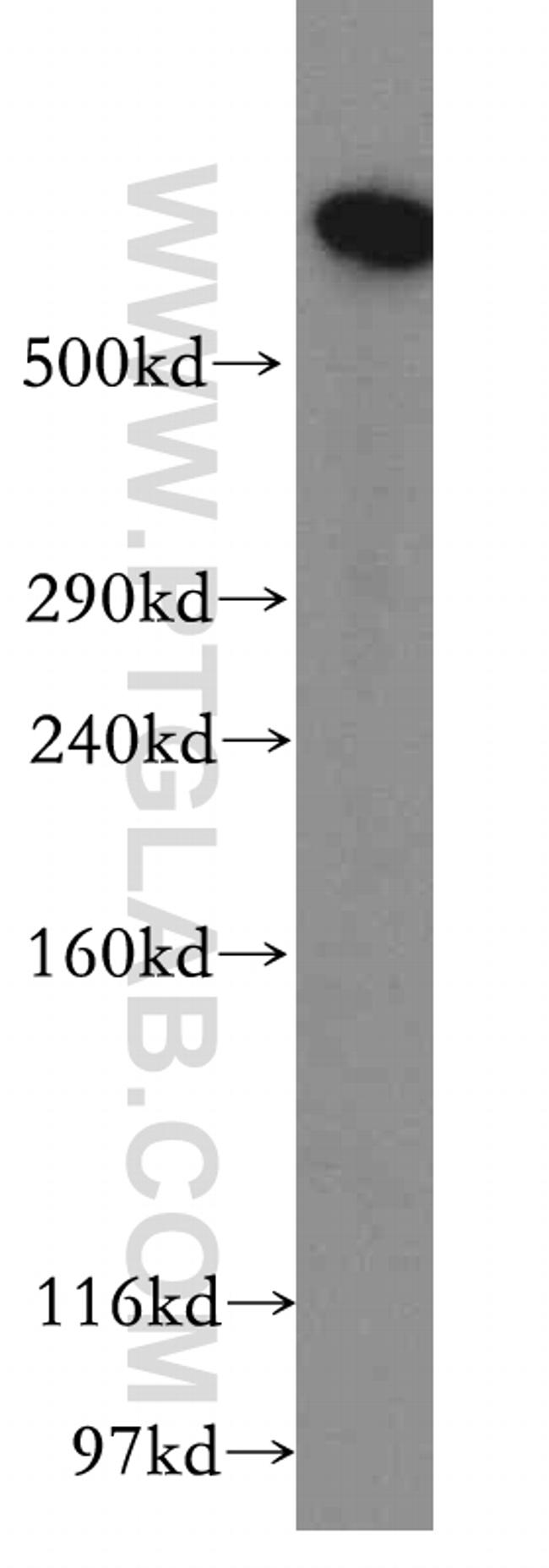 DYNC1H1 Antibody in Western Blot (WB)