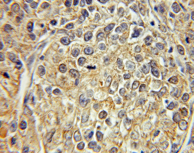 FABP5 Antibody in Immunohistochemistry (Paraffin) (IHC (P))