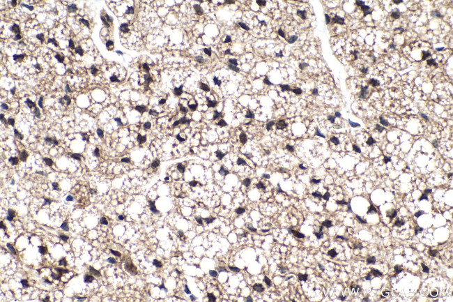 FABP5 Antibody in Immunohistochemistry (Paraffin) (IHC (P))