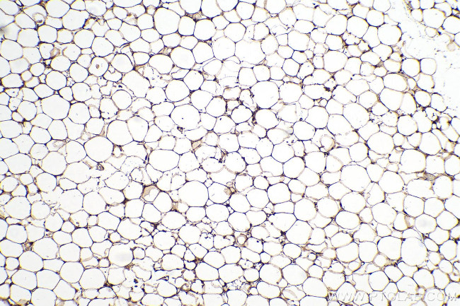 FABP5 Antibody in Immunohistochemistry (Paraffin) (IHC (P))