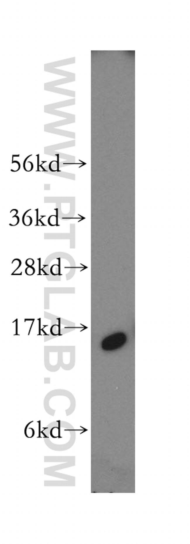 FABP5 Antibody in Western Blot (WB)