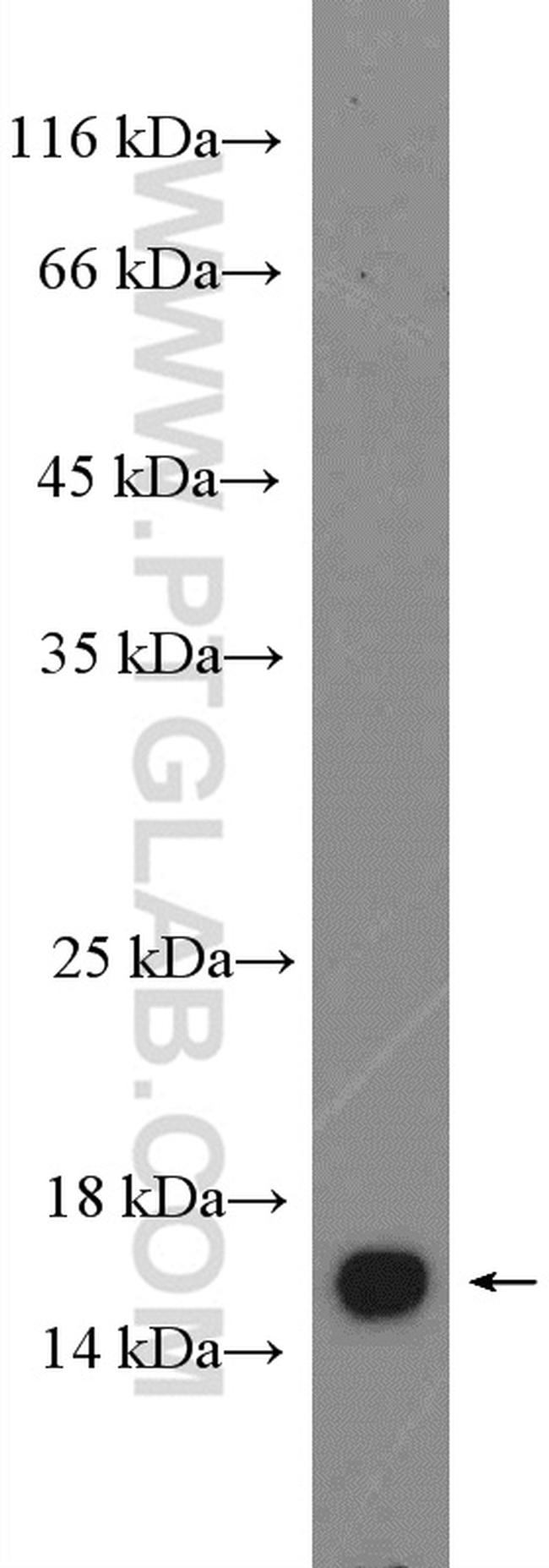 FABP5 Antibody in Western Blot (WB)