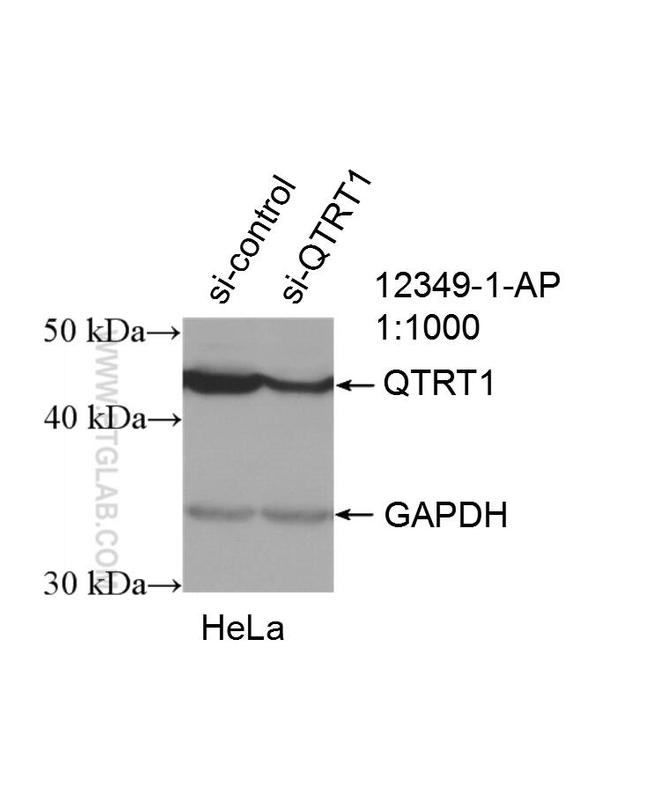 QTRT1 Antibody in Western Blot (WB)