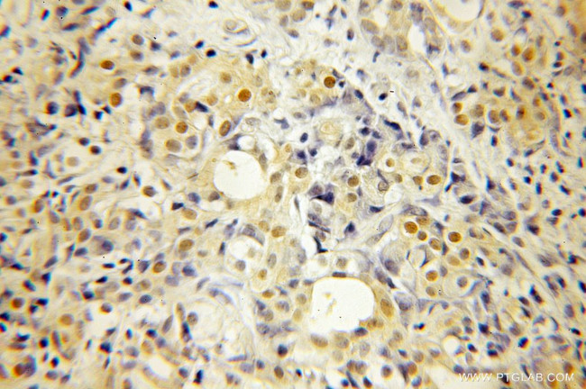 CABYR Antibody in Immunohistochemistry (Paraffin) (IHC (P))