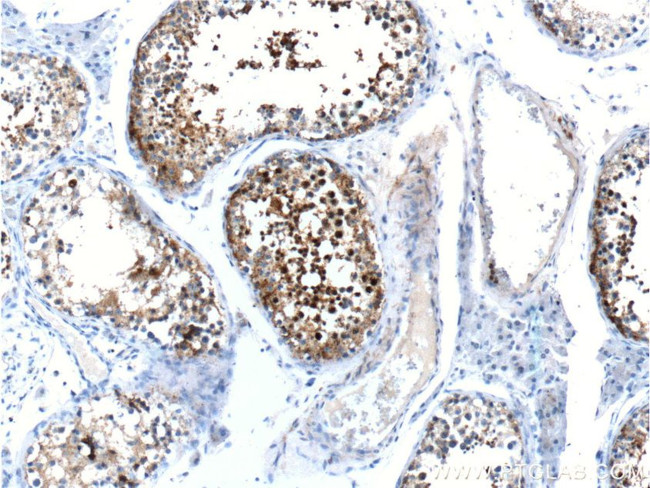 CABYR Antibody in Immunohistochemistry (Paraffin) (IHC (P))