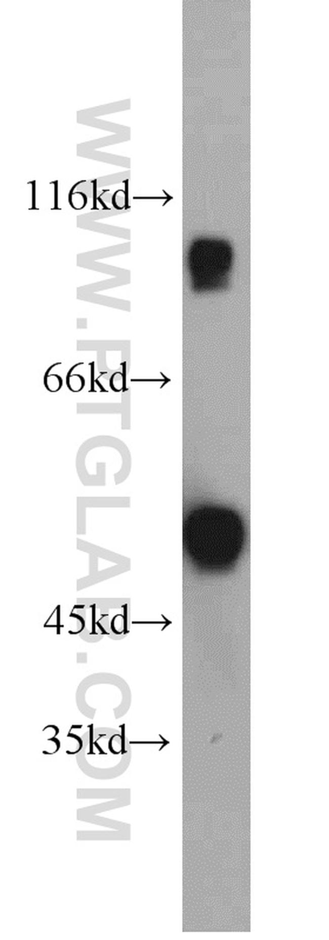 CABYR Antibody in Western Blot (WB)